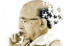Ako bojovať s Alzheimerom